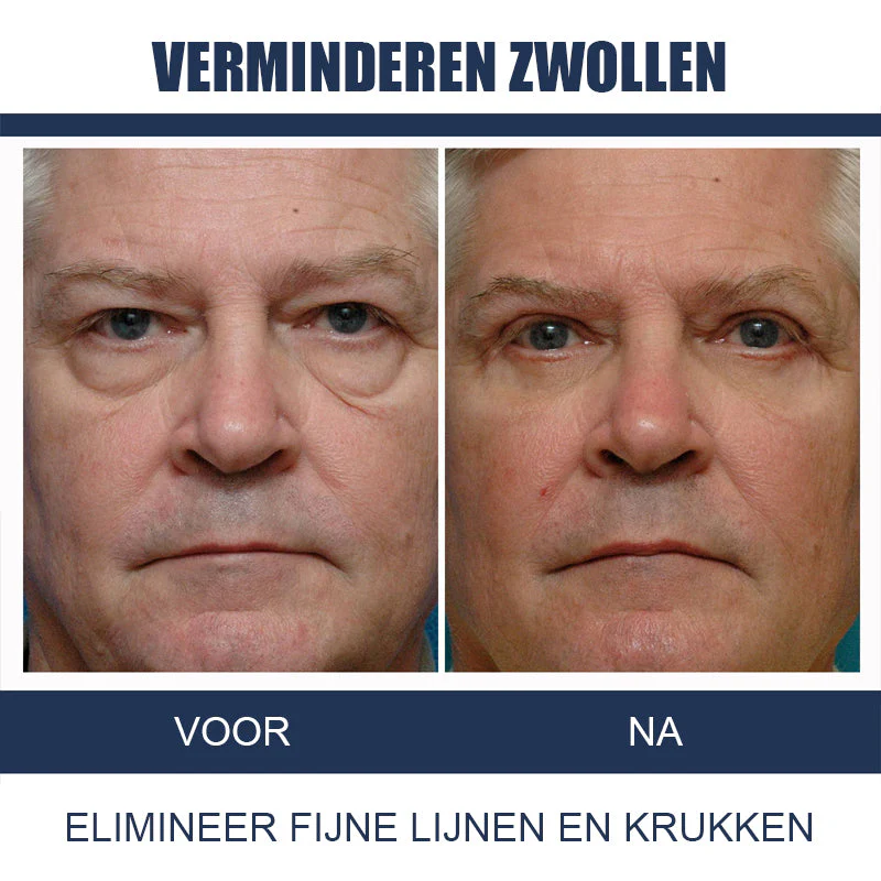 Productafbeelding 9